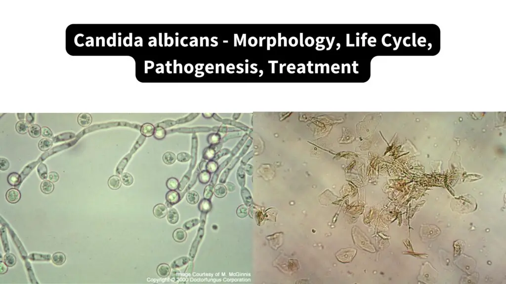 Candida Albicans Morphology Mzunguko Wa Maisha Pathogenesis Matibabu