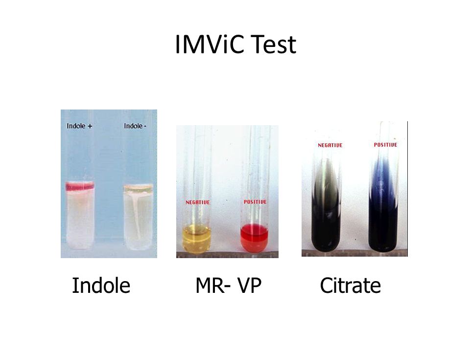 IMViC test procedure