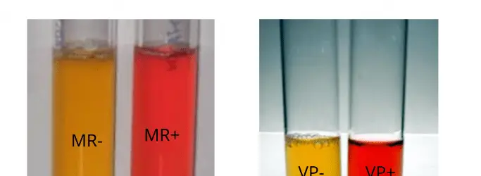 Methyl Red and Voges Proskauer Test