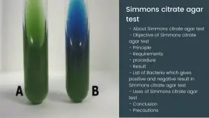 Simmons citrate agar test