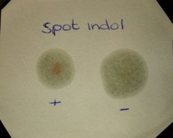 spot indole test