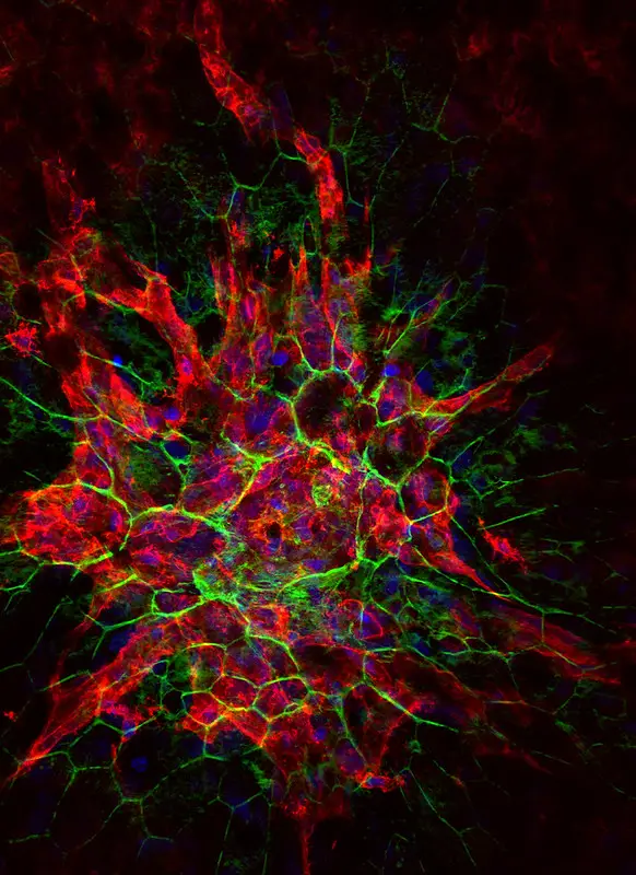 Confocal microscope image of laser-induced choroidal neovascular (CNV)