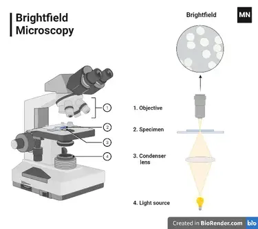 Types Of Microscopes With Definitions, Principle, Uses, Labeled Diagrams