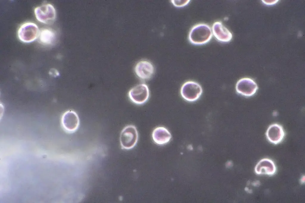 Red blood cells as seen by darkfield microscopy x 1000
