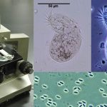Phase Contrast Microscopy