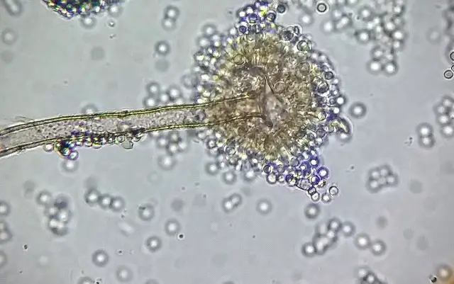 Study of Aspergillus by using Temporary Mount 