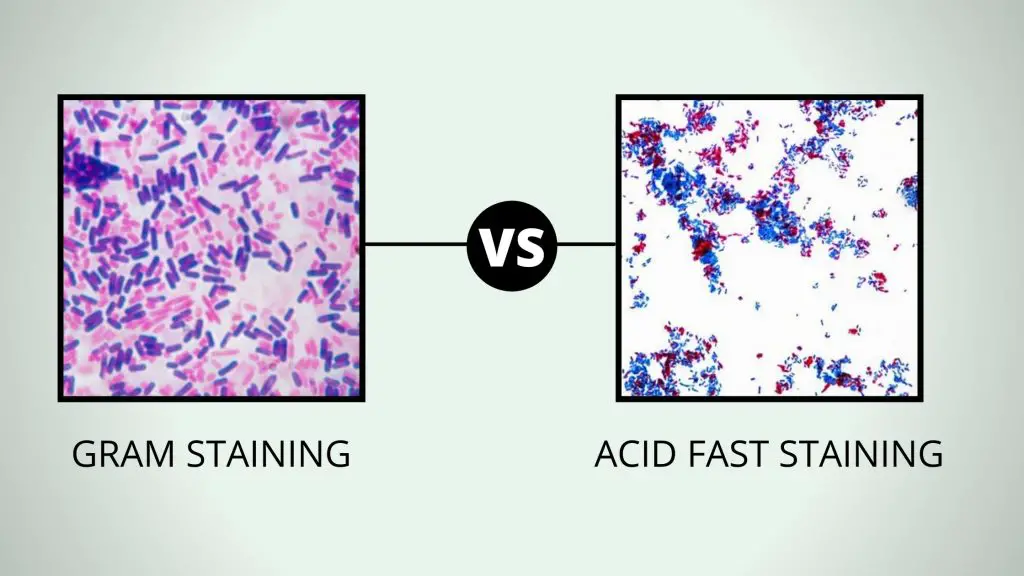 Comparison Between Gram Stain and Acid Fast