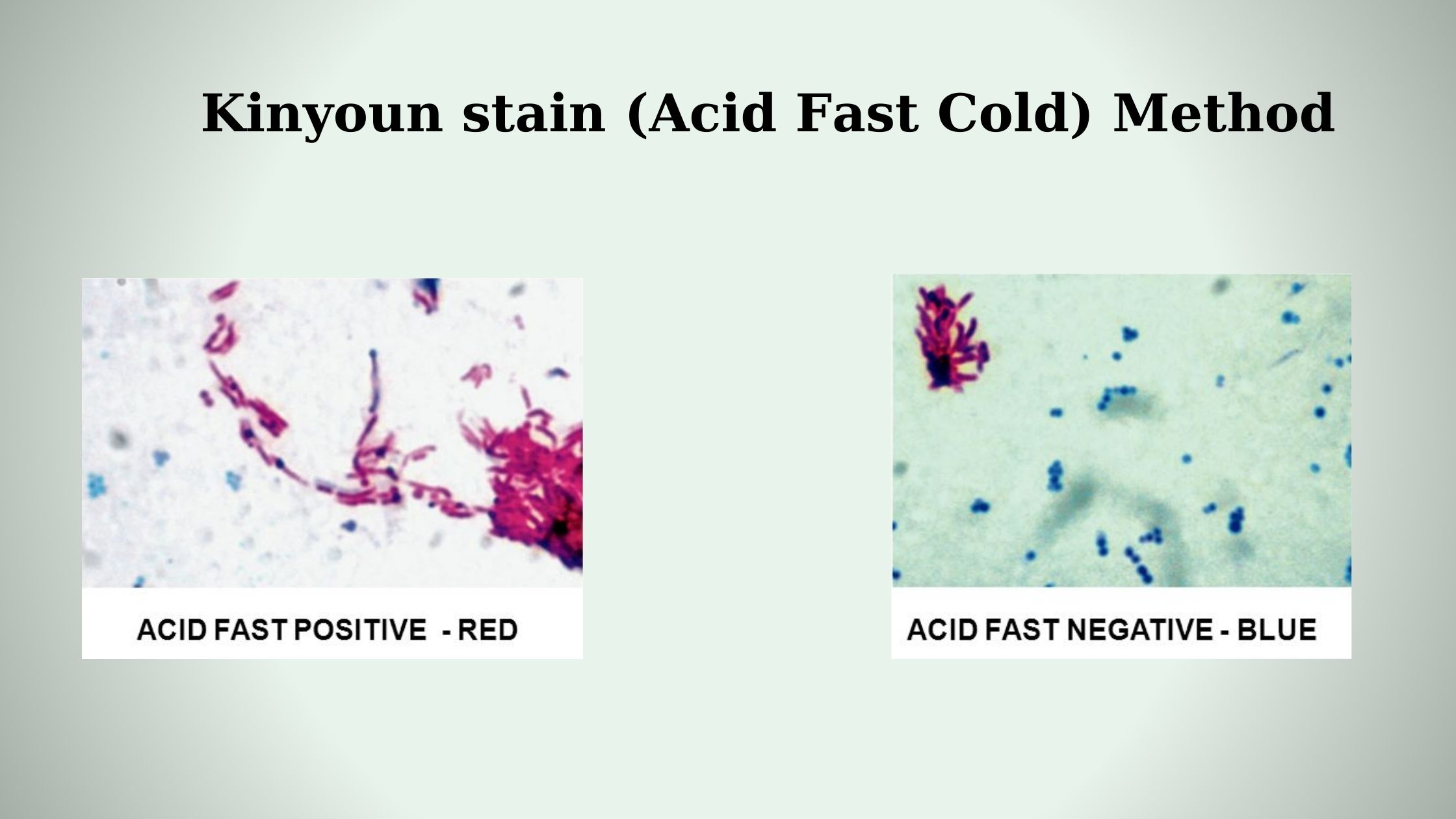 Kinyoun stain (Acid Fast Cold) Method: Principle, Procedure, Result