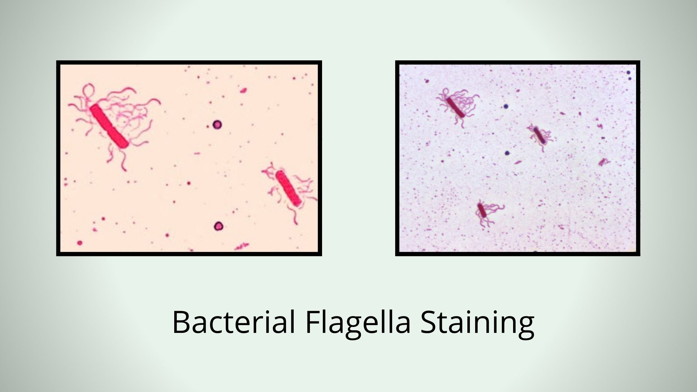 Bacterial Flagella Staining by Leifson Flagella Stain Method