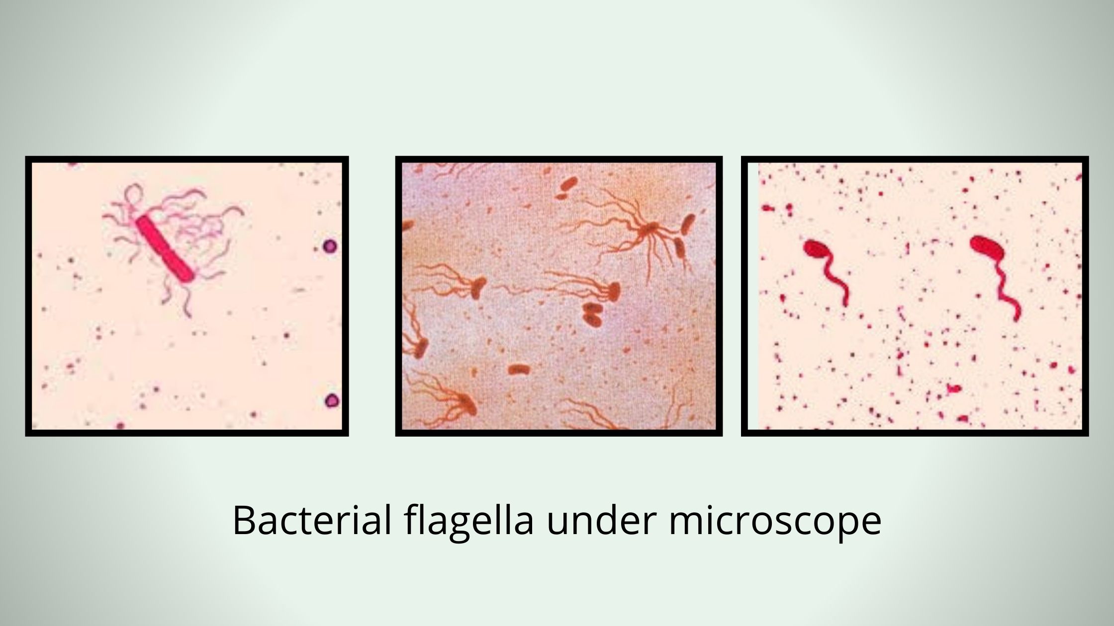 Flagella Staining Principle, Procedure, Result