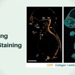 Collagen Hybridizing Peptide Staining
