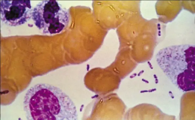 The bipolar staining characteristic of Yersinia is visible in Wright-Giemsa-stained peripheral blood smears from bubonic plague patients. Attention: "closed safety pin" shaped cells stained with bipolar.