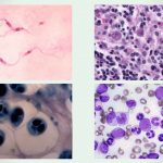 Giemsa Stain: Staining Procedure, Principle, Result and Application
