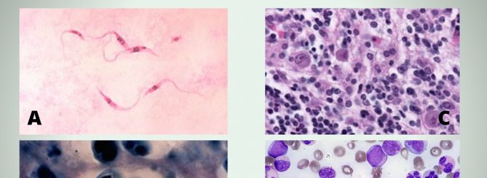 Giemsa Stain: Staining Procedure, Principle, Result and Application