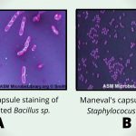 Maneval's capsule staining