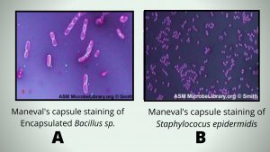 Maneval's capsule staining