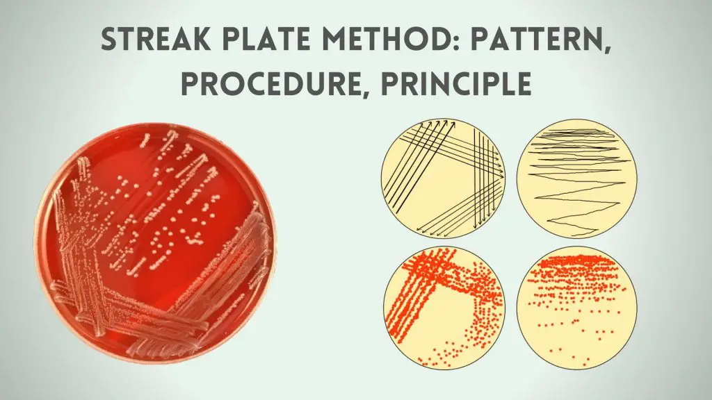 Streak Plate Method: Patterns, Procedure, Principle