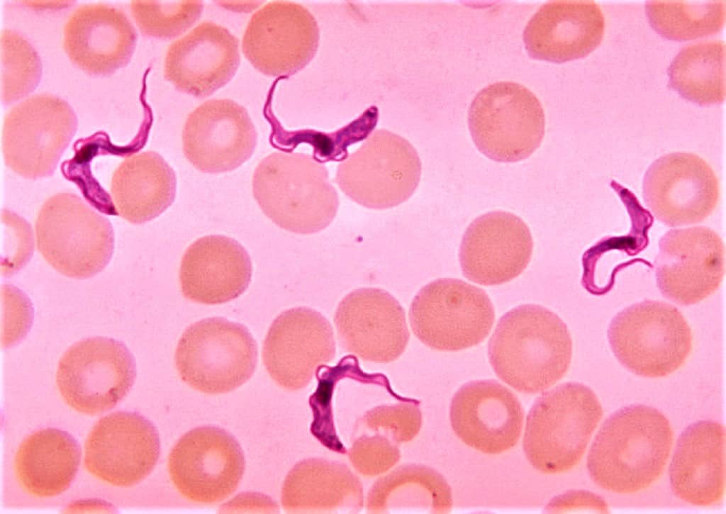 THICK BLOOD SMEAR SHOWING TRYPANOSOMA SPECIES
