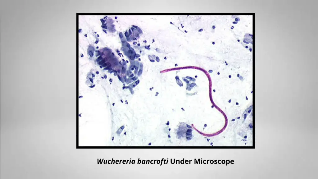 Wuchereria bancrofti under microscope