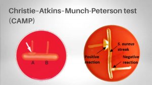 Christie, Atkins, and Munch-Peterson (CAMP) test