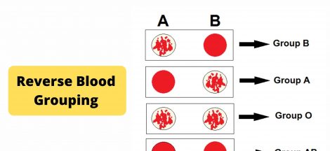 Reverse Blood Grouping