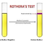 Rothera’s Test