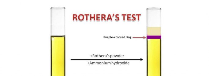 Rothera’s Test