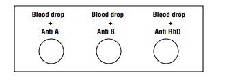 ABO blood Grouping Procedure