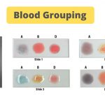 Blood Grouping Principle and Procedure