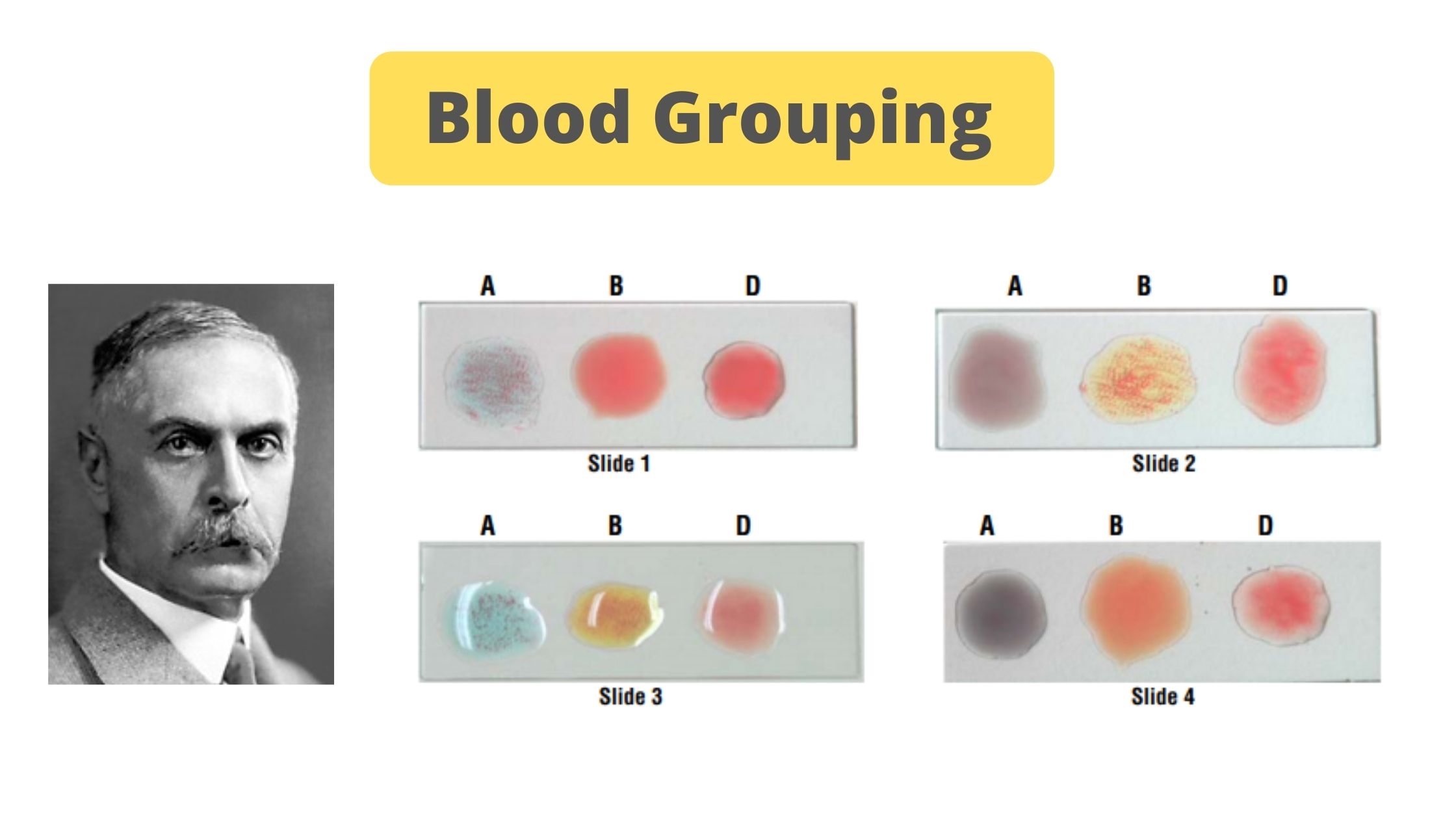 Blood Grouping Principle and Procedure