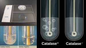 Catalase Test Principle, Procedure, Result and Application.