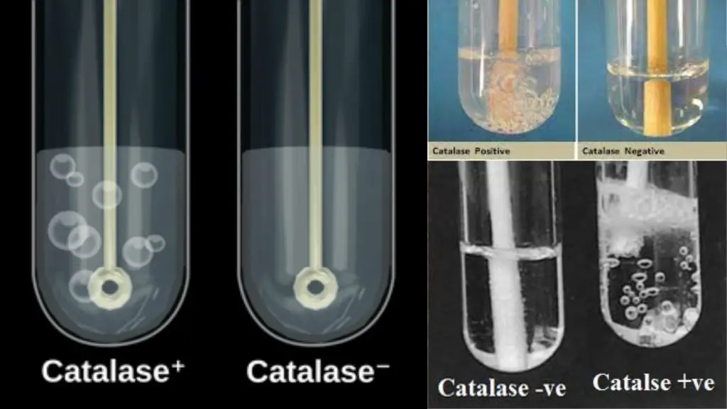 Tube Method of Catalase Test