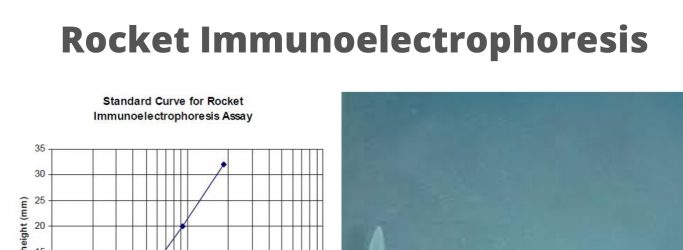 Rocket Immunoelectrophoresis Principle, Procedure, Result, Application.