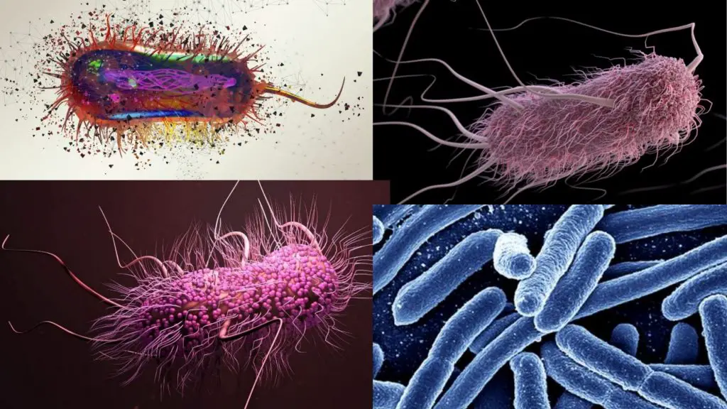 Escherichia coli morphology, arrangement, Cultural Characteristics, Pathogenicity, Diagnosis