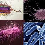 Escherichia coli morphology, arrangement, Cultural Characteristics, Pathogenicity, Diagnosis