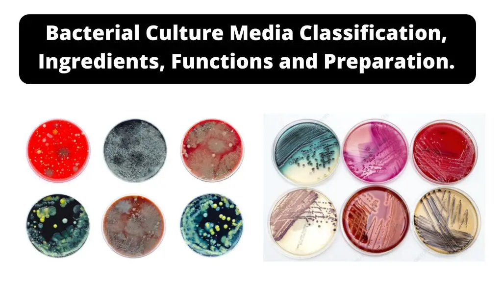 Bacterial Culture Media Classification, Ingredients, Functions and Preparation.