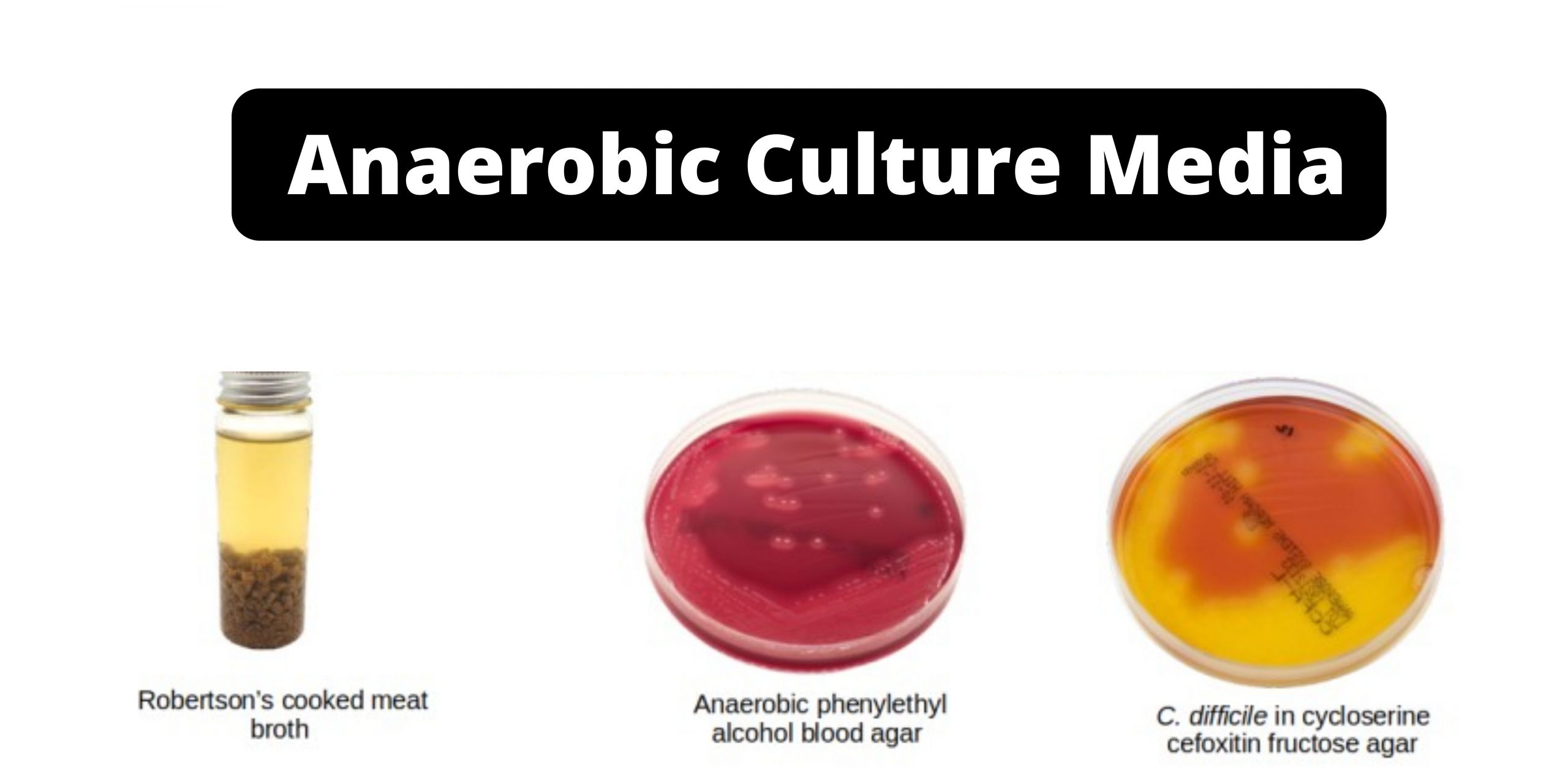 Anaerobic Culture Media Examples, Definition