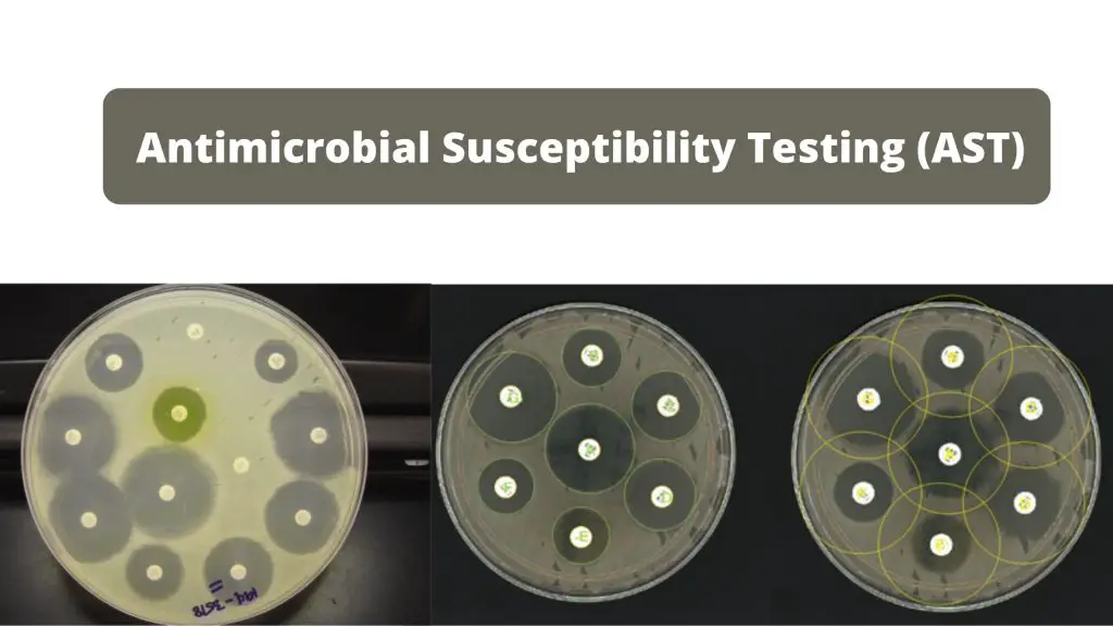 Antimicrobial Susceptibility Testing (AST)