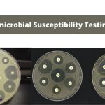 Antimicrobial Susceptibility Testing (AST)