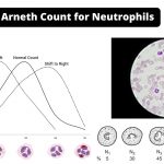 Arneth Count for Neutrophils: Principle, Procedure and Clinical Significance