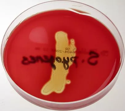 This streptococcus pyogenes exhibits β-hemolysis.