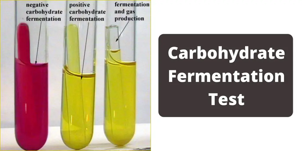 Carbohydrate Fermentation Test - Sugar Fermentation Test