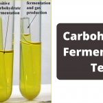 Carbohydrate Fermentation Test - Sugar Fermentation Test