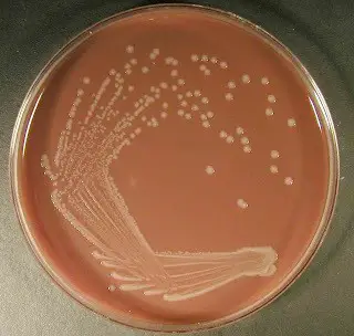 Haemophilus influenzae on chocolate agar
