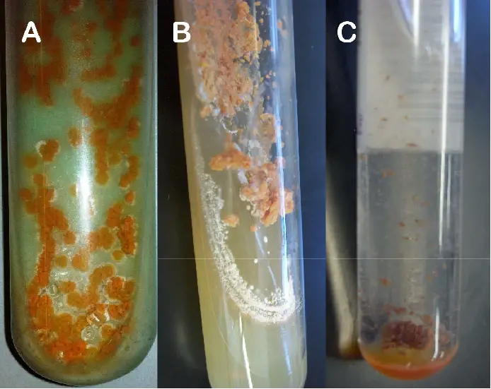 Macroscopic growth of Nocardia sp. in: A) Lowenstein Jensen medium, B) Agar Sabouraud and C) Bactec MGIT medium.  