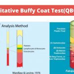 Quantitative Buffy Coat Test(QBC Test)