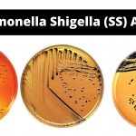Salmonella Shigella (SS) Agar Principle, Composition, Application