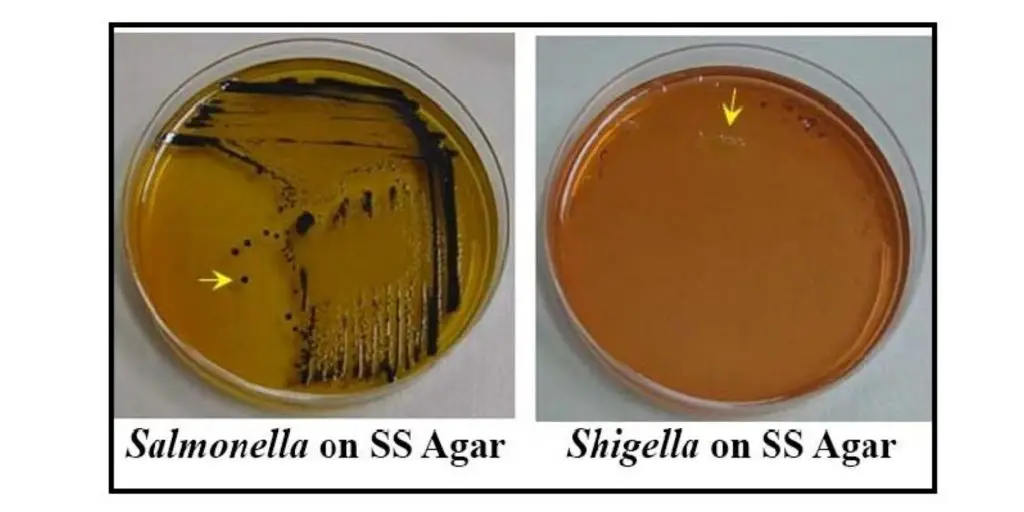 Salmonella Shigella (SS) Agar result