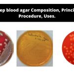 Sheep blood agar Composition, Principle, Procedure, Uses.