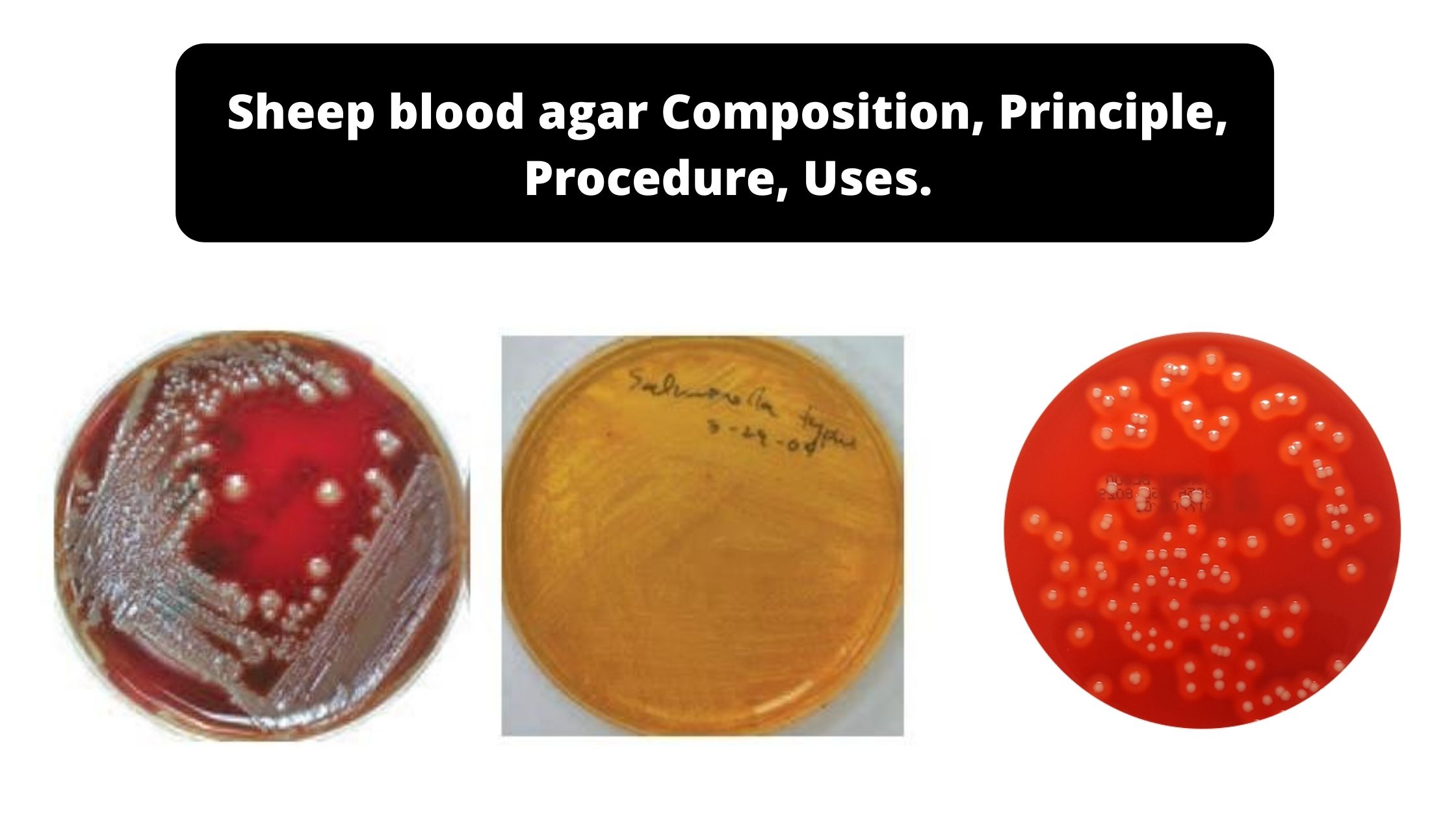 Sheep blood agar Composition, Principle, Procedure, Uses.